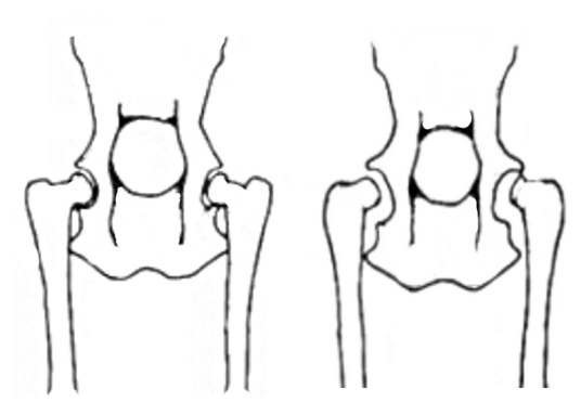 drawing of healthy hips in dogs vs hip dysplasia